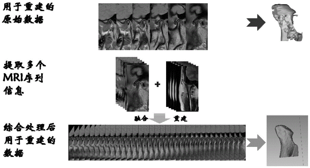 一种三维重建颞下颌关节的方法